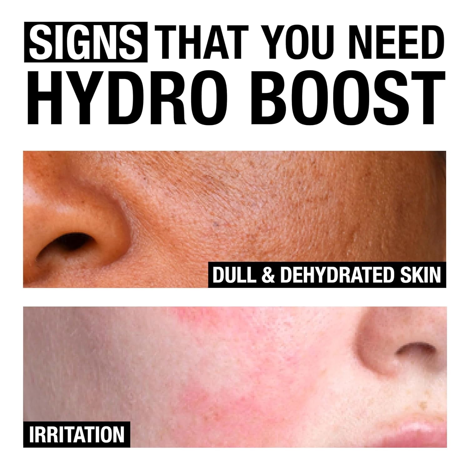 Hydro Boost Facial Cleansing Gel